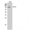 ZNF420 Antibody - Western blot of ZNF420 antibody