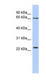 ZNF428 Antibody - ZNF428 antibody Western blot of Fetal Intestine lysate. This image was taken for the unconjugated form of this product. Other forms have not been tested.