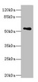 ZNF434 Antibody - Western blot All lanes: ZSCAN32 antibody at 1µg/ml + MCF-7 whole cell lysate Secondary Goat polyclonal to rabbit IgG at 1/10000 dilution Predicted band size: 79, 55, 47 kDa Observed band size: 55 kDa