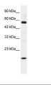 ZNF436 Antibody - HepG2 Cell Lysate.  This image was taken for the unconjugated form of this product. Other forms have not been tested.