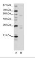 ZNF440 Antibody - A: Marker, B: HepG2 Cell Lysate.  This image was taken for the unconjugated form of this product. Other forms have not been tested.