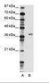 ZNF444 Antibody - A: Marker, B: Jurkat Cell Lysate.  This image was taken for the unconjugated form of this product. Other forms have not been tested.