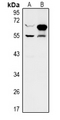 ZNF446 Antibody - Western blot analysis of ZNF446 expression in PC12 (A), A549 (B) whole cell lysates.