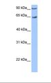 ZNF449 Antibody - Transfected 293T cell lysate. Antibody concentration: 1.0 ug/ml. Gel concentration: 12%.  This image was taken for the unconjugated form of this product. Other forms have not been tested.