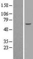 ZNF449 Protein - Western validation with an anti-DDK antibody * L: Control HEK293 lysate R: Over-expression lysate