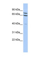 ZNF471 Antibody - ZNF471 antibody Western blot of HepG2 cell lysate. This image was taken for the unconjugated form of this product. Other forms have not been tested.