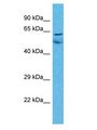 ZNF48 Antibody - ZNF48 antibody Western Blot of Lung Tumor. Antibody dilution: 1 ug/ml.  This image was taken for the unconjugated form of this product. Other forms have not been tested.