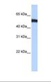 ZNF486 Antibody - Fetal muscle cell lysate. Antibody concentration: 0.5 ug/ml. Gel concentration: 12%.  This image was taken for the unconjugated form of this product. Other forms have not been tested.