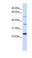 ZNF488 Antibody - ZNF488 antibody Western blot of HeLa lysate. This image was taken for the unconjugated form of this product. Other forms have not been tested.