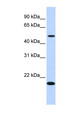 ZNF493 Antibody - ZNF493 antibody Western blot of Fetal Liver lysate.