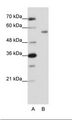 ZNF497 Antibody - A: Marker, B: HepG2 Cell Lysate.  This image was taken for the unconjugated form of this product. Other forms have not been tested.