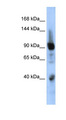 ZNF507 Antibody - ZNF507 antibody Western blot of Fetal Muscle lysate. This image was taken for the unconjugated form of this product. Other forms have not been tested.