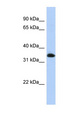 ZNF511 Antibody - ZNF511 antibody Western blot of Transfected 293T cell lysate. This image was taken for the unconjugated form of this product. Other forms have not been tested.