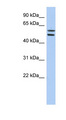 ZNF513 Antibody - ZNF513 antibody Western blot of HT1080 cell lysate. This image was taken for the unconjugated form of this product. Other forms have not been tested.