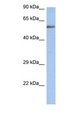 ZNF513 Antibody - ZNF513 antibody Western blot of Fetal Kidney lysate. This image was taken for the unconjugated form of this product. Other forms have not been tested.