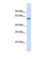 ZNF527 Antibody - Western blot of Human Placenta. ZNF527 antibody dilution 1.0 ug/ml.  This image was taken for the unconjugated form of this product. Other forms have not been tested.
