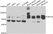 ZNF544 Antibody - Western blot analysis of extracts of various cell lines.