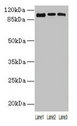 ZNF546 Antibody - Western blot All lanes: ZNF546 antibody at 4µg/ml Lane 1: A549 whole cell lysate Lane 2: 293T whole cell lysate Lane 3: Hela whole cell lysate Secondary Goat polyclonal to rabbit IgG at 1/10000 dilution Predicted band size: 98 kDa Observed band size: 98 kDa