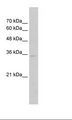 ZNF547 Antibody - Jurkat Cell Lysate.  This image was taken for the unconjugated form of this product. Other forms have not been tested.