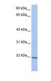 ZNF548 Antibody - MCF7 cell lysate. Antibody concentration: 1.0 ug/ml. Gel concentration: 12%.  This image was taken for the unconjugated form of this product. Other forms have not been tested.