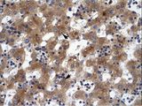 ZNF551 Antibody - ZNF551 antibody ARP36133_T100-BAC03625-ZNF551 (zinc finger protein 551) Antibody was used in IHC to stain formalin-fixed, paraffin-embedded human liver.  This image was taken for the unconjugated form of this product. Other forms have not been tested.