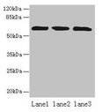ZNF554 Antibody - Western blot All lanes: ZNF554 antibody at 5µg/ml Lane 1: K562 whole cell lysate Lane 2: U937 whole cell lysate Lane 3: A549 whole cell lysate Secondary Goat polyclonal to rabbit IgG at 1/10000 dilution Predicted band size: 61 kDa Observed band size: 61 kDa