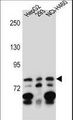 ZNF555 Antibody - ZNF555 Antibody western blot of HepG2,293,NCI-H460 cell line lysates (35 ug/lane). The ZNF555 antibody detected the ZNF555 protein (arrow).