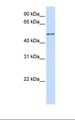 ZNF561 Antibody - 293T cell lysate. Antibody concentration: 1.0 ug/ml. Gel concentration: 12%.  This image was taken for the unconjugated form of this product. Other forms have not been tested.
