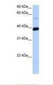 ZNF562 Antibody - 721_B cell lysate. Antibody concentration: 0.5 ug/ml. Gel concentration: 12%.  This image was taken for the unconjugated form of this product. Other forms have not been tested.