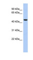 ZNF566 Antibody - ZNF566 antibody Western blot of Fetal Kidney lysate. This image was taken for the unconjugated form of this product. Other forms have not been tested.