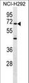 ZNF568 Antibody - ZNF568 Antibody western blot of NCI-H292 cell line lysates (35 ug/lane). The ZNF568 antibody detected the ZNF568 protein (arrow).