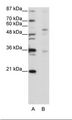 ZNF57 Antibody - A: Marker, B: Jurkat Cell Lysate.  This image was taken for the unconjugated form of this product. Other forms have not been tested.