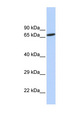 ZNF571 Antibody - ZNF571 antibody Western blot of HeLa lysate. This image was taken for the unconjugated form of this product. Other forms have not been tested.