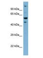 ZNF573 Antibody - ZNF573 antibody Western Blot of HT1080. Antibody dilution: 1 ug/ml.  This image was taken for the unconjugated form of this product. Other forms have not been tested.