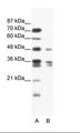 ZNF577 Antibody - A: Marker, B: Jurkat Cell Lysate.  This image was taken for the unconjugated form of this product. Other forms have not been tested.