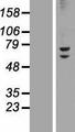 ZNF582 Protein - Western validation with an anti-DDK antibody * L: Control HEK293 lysate R: Over-expression lysate