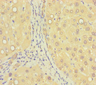 ZNF583 Antibody - Immunohistochemistry of paraffin-embedded human liver tissue using ZNF583 Antibody at dilution of 1:100