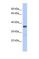 ZNF586 Antibody - Western blot of Human ACHN. ZNF586 antibody dilution 1.0 ug/ml.  This image was taken for the unconjugated form of this product. Other forms have not been tested.
