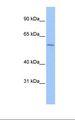 ZNF596 Antibody - Hela cell lysate. Antibody concentration: 0.5 ug/ml. Gel concentration: 8%.  This image was taken for the unconjugated form of this product. Other forms have not been tested.