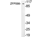 ZNF598 Antibody - Western blot analysis of lysates from human lung, using ZFP598 antibody.