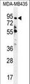ZNF605 Antibody - ZNF605 Antibody western blot of MDA-MB435 cell line lysates (35 ug/lane). The ZNF605 antibody detected the ZNF605 protein (arrow).