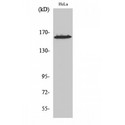 ZNF608 Antibody - Western blot of ZNF608 antibody