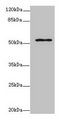 ZNF610 Antibody - Western blot All lanes: ZNF610 antibody at 7µg/ml Lane 1: HepG2 whole cell lysate Lane 2: Hela whole cell lysate Lane 3: MCF-7 whole cell lysate Secondary Goat polyclonal to rabbit IgG at 1/10000 dilution Predicted band size: 54, 49 kDa Observed band size: 54 kDa