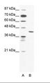 ZNF621 Antibody - A: Marker, B: Jurkat Cell Lysate.  This image was taken for the unconjugated form of this product. Other forms have not been tested.