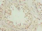 ZNF622 Antibody - Immunohistochemistry of paraffin-embedded human testis tissue using antibody at dilution of 1:100.