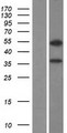 ZNF645 Protein - Western validation with an anti-DDK antibody * L: Control HEK293 lysate R: Over-expression lysate