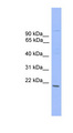 ZNF655 Antibody - ZNF655 antibody Western blot of COLO205 cell lysate. This image was taken for the unconjugated form of this product. Other forms have not been tested.