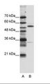 ZNF655 Antibody - A: Marker, B: HepG2 Cell Lysate.  This image was taken for the unconjugated form of this product. Other forms have not been tested.