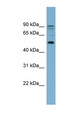 ZNF662 Antibody - ZNF662 antibody Western blot of OVCAR-3 cell lysate. This image was taken for the unconjugated form of this product. Other forms have not been tested.