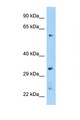 ZNF664 Antibody - ZNF664 antibody Western blot of Mouse Kidney lysate. Antibody concentration 1 ug/ml.  This image was taken for the unconjugated form of this product. Other forms have not been tested.